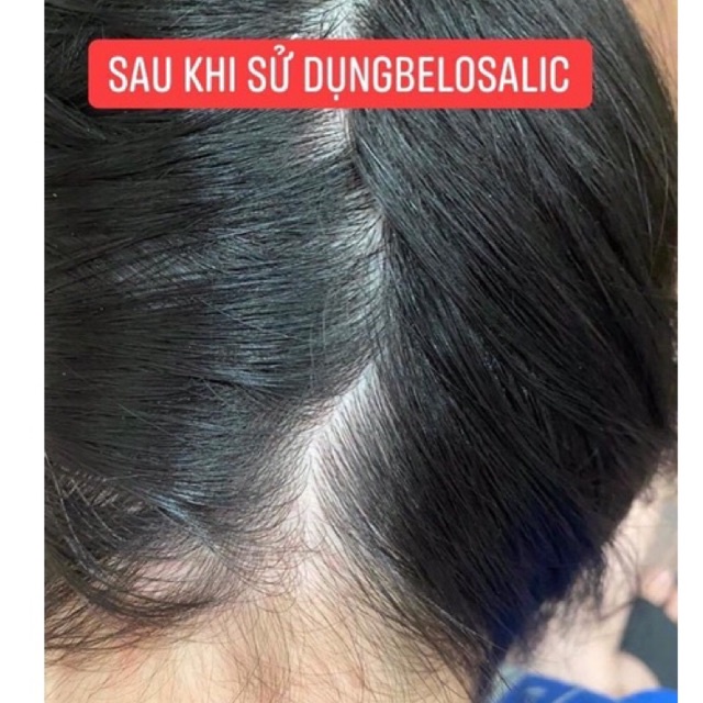 Kem bôi da cơ địa, viêm da dị ứng Belosalic Nga 30gr - Bachduongrushop