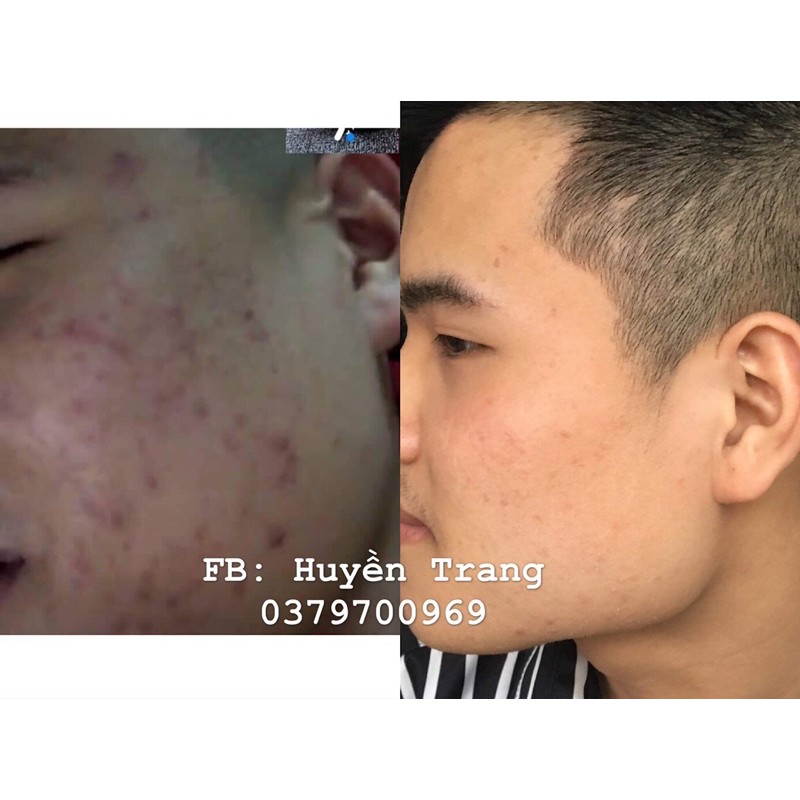 THUỐC BẮC TÁI TẠO DA (HANDMADE) 125ml | BigBuy360 - bigbuy360.vn