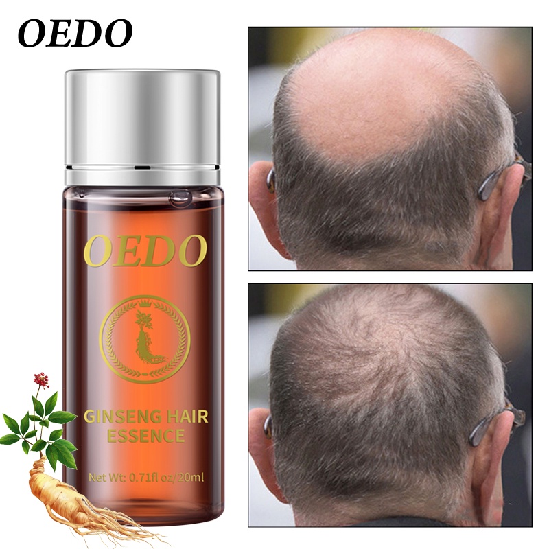 Set 2 serum tinh chất nhân sâm OEDO kích thích tóc mọc dày phục hồi chân tóc mạnh mẽ nhanh chóng