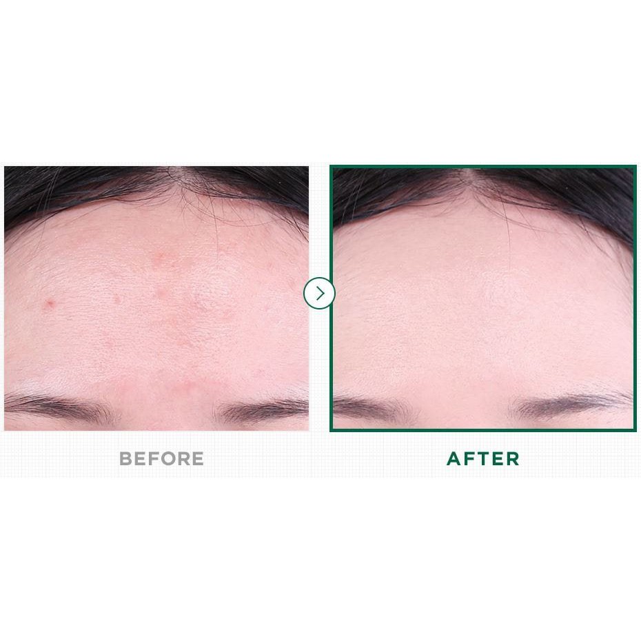 Phấn Nước Cho Da Mụn VT CICA REDNESS COVER & MOISTURE COVER CUSHION | BigBuy360 - bigbuy360.vn