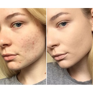 Kem Che Khuyết Điểm  Catrice Liquid Camouflage High Coverage Concealer 12h