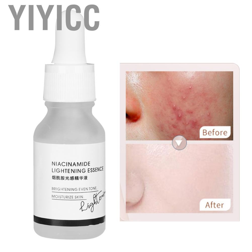 (hàng Mới Về) Dung Dịch Tẩy Mực Xóa Hình Xăm Bán Vĩnh Cửu Yiyicc Wujnbop 30ml