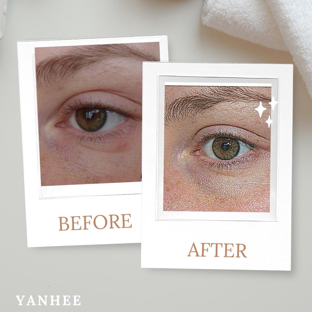 Kem giảm thâm quầng mắt Yanhee Eye Gel giúp mờ nếp nhăn xóa vết thâm và tan bọng mắt 5g chính hãng thái lan