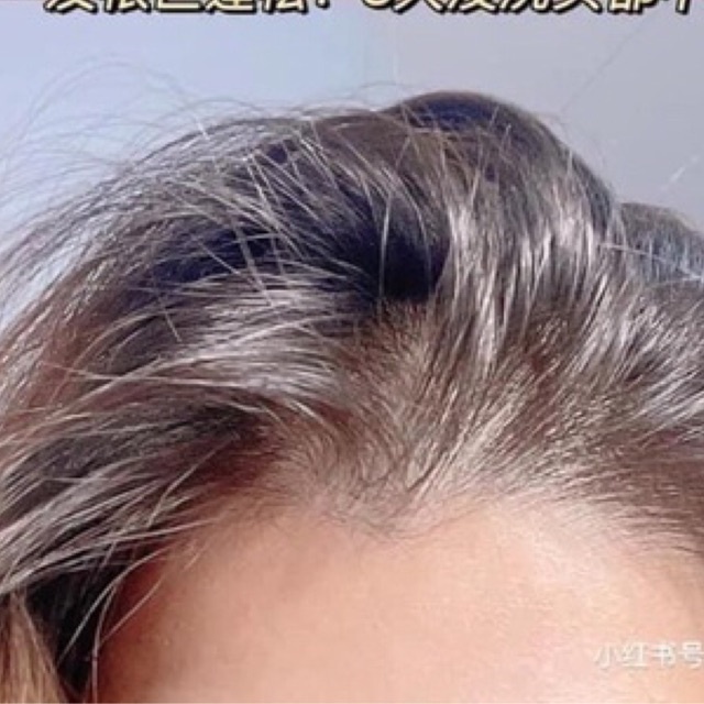 Tẩy tế bào chết da đầu 49k( về sẵn sll) | BigBuy360 - bigbuy360.vn