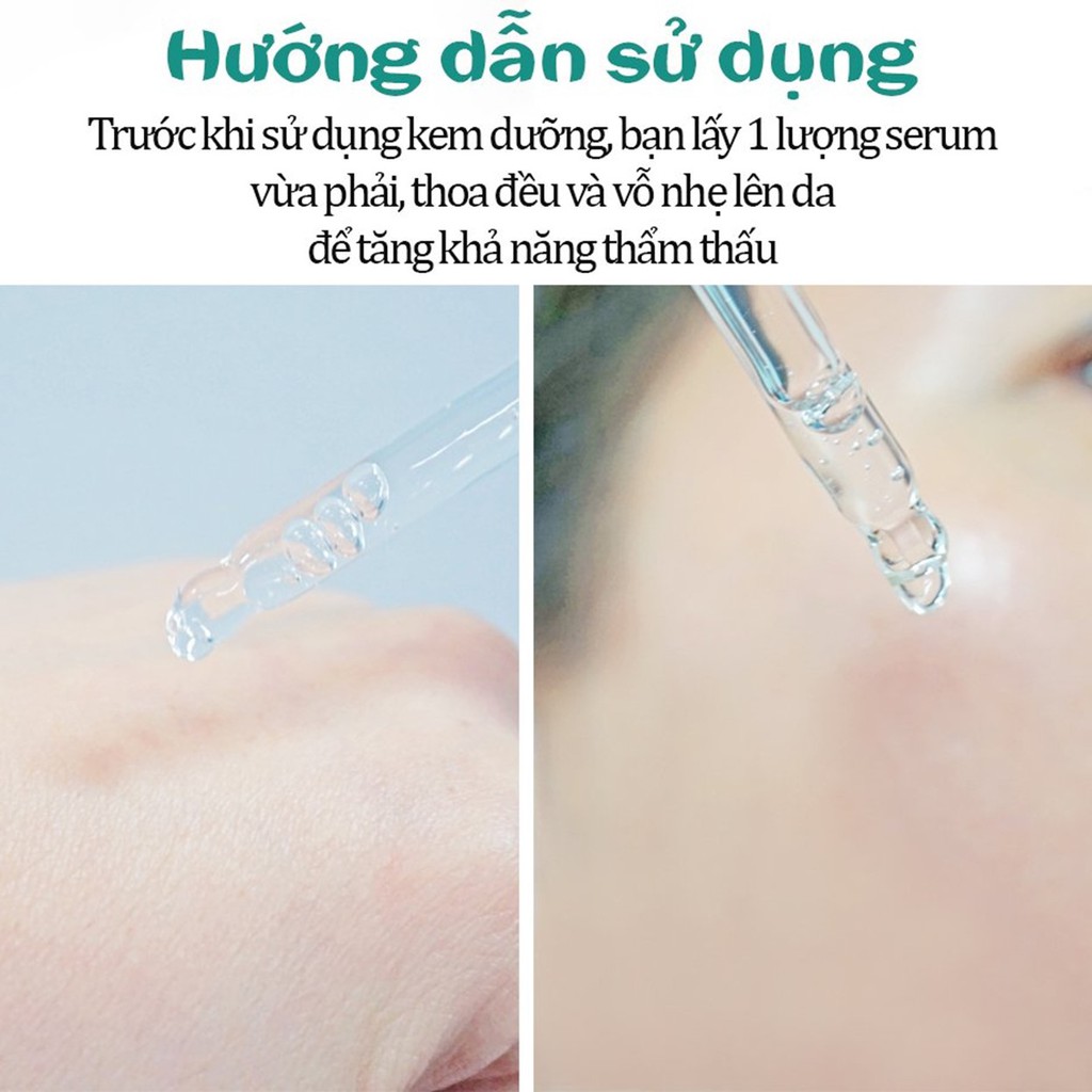 Serum dưỡng da trắng mịn, cải thiện da, ngừa lão hóa da Care:nel Niacinamide 10% + Zinc 1% 30ml