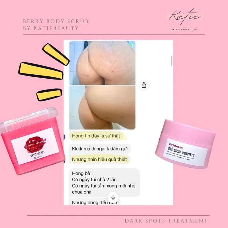 Kem thoa thâm Mông, mụn Mông, Bẹn, Nách, Lưng, Cùi chỏ, Đầu gối  Dark spot lotion