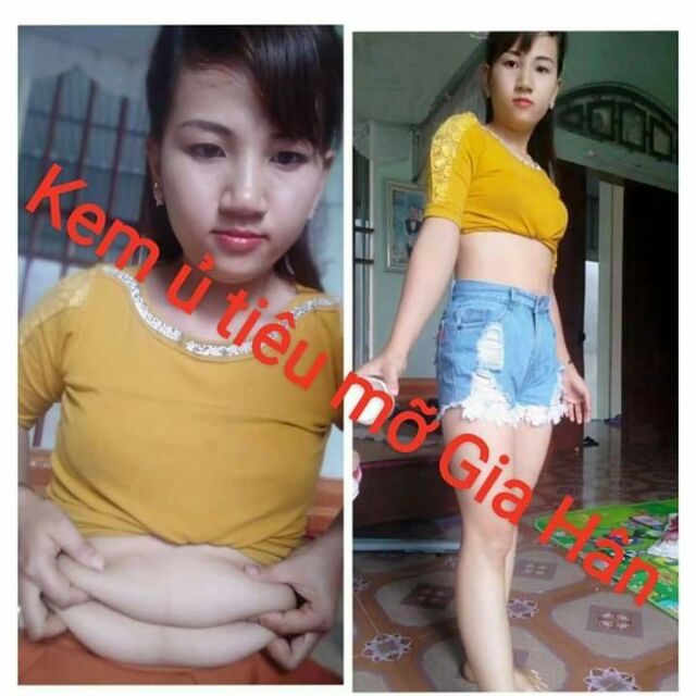 Kem ủ tiêu mỡ gia hân