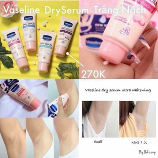 ??VASELINE DRYSERUM TRẮNG NÁCH??