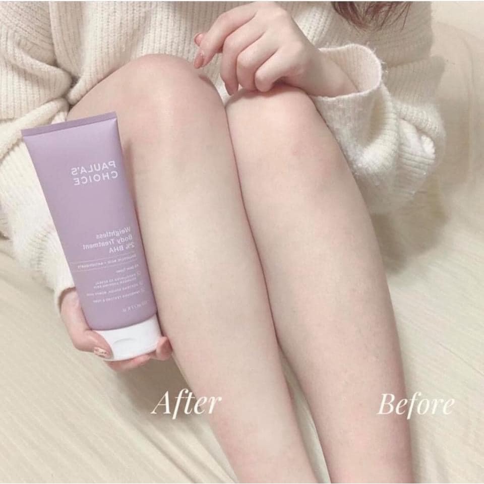 Kem dưỡng thể ngừa viêm lỗ chân lông chứa 2% BHA Paula's Choice Weightless Body Treatment 2% BHA 210ml | BigBuy360 - bigbuy360.vn