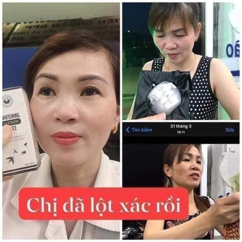 Combo Nám, Tàn Nhang - Giúp Da Trắng Hồng Mềm Mịn + Mặt Nạ