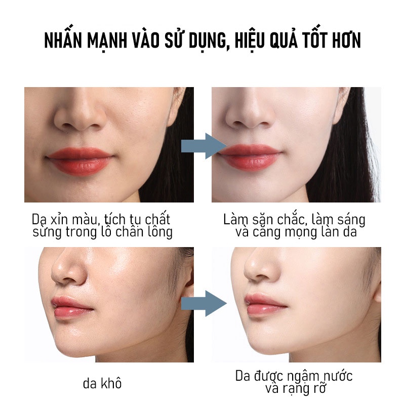 Mặt Nạ Dưỡng Ẩm Làm Da Trẻ Hơn, Làm Mờ Đốm Đen Và Nếp Nhăn