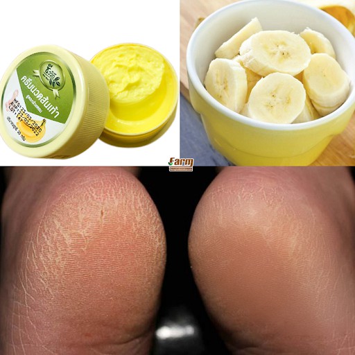 Kem Giảm Nứt Gót Chân BANANA HEEL CREAM 30g Thái Lan