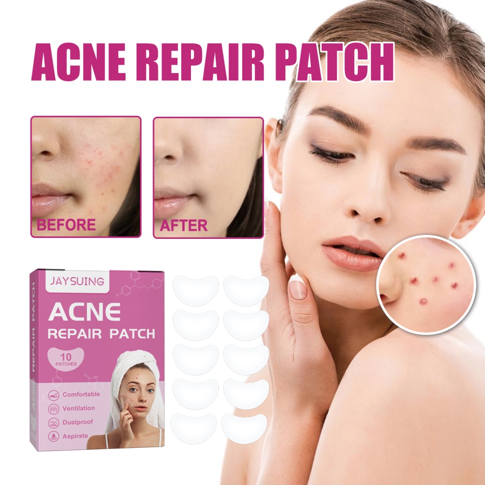 Miếng Dán Hỗ Trợ Giảm Mụn Chống Thấm Nước Chăm Sóc Da