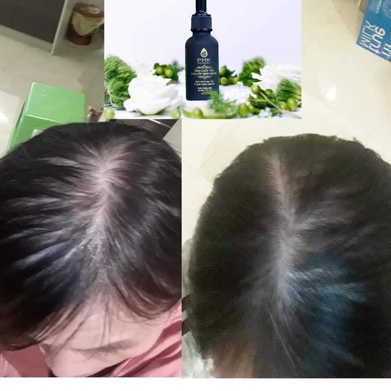Tinh chất mọc tóc Cao Cấp Phúc Minh Khang