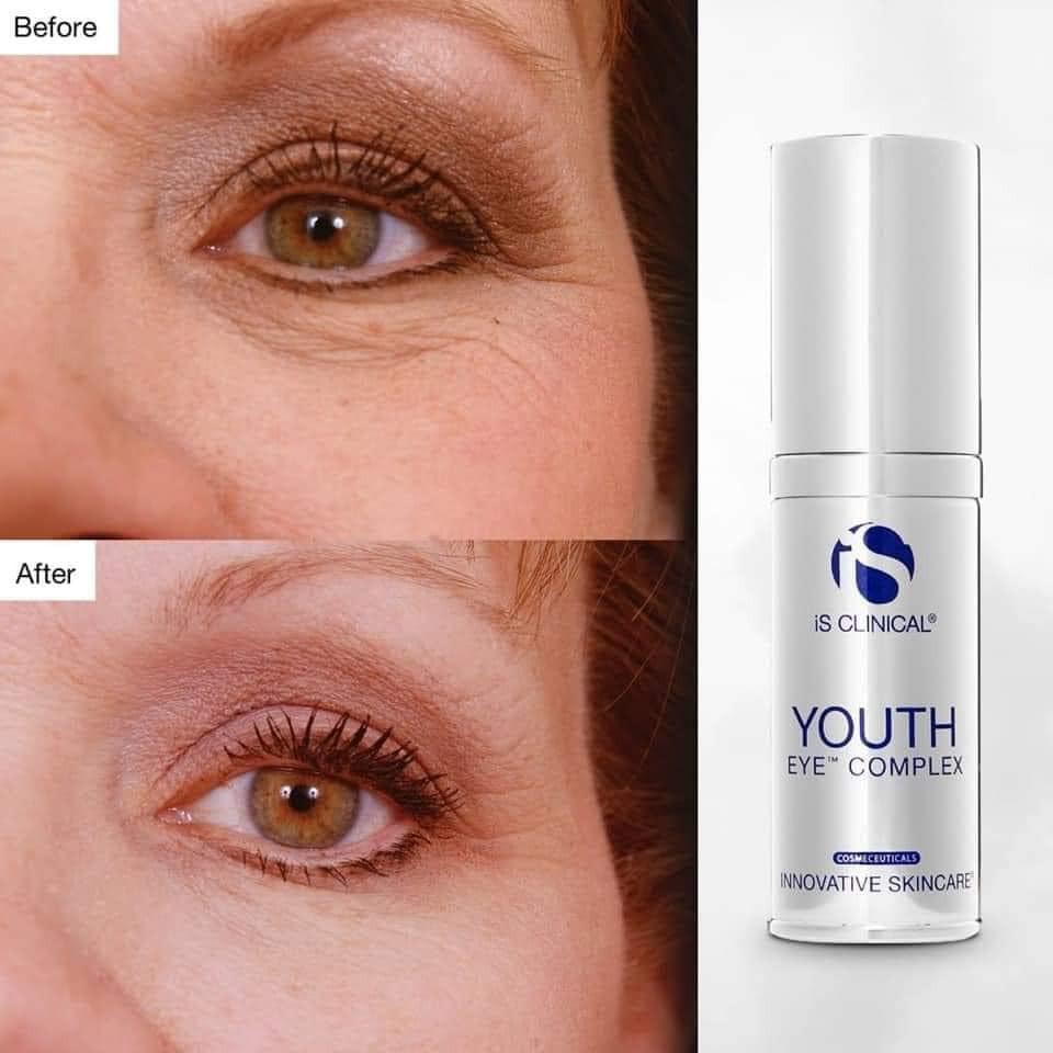 [iS Clinical Youth Eye Complex] Kem siêu đánh tan bọng mắt, giảm thâm và nếp nhăn iS Clinical Youth Eye Complex