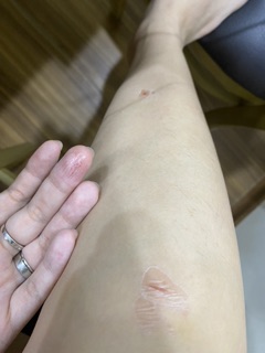 Liquid Bandage - băng cá nhân dạng nước