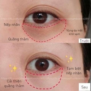 Mặt nạ mắt JM Solution eye patch hộp 60 miếng