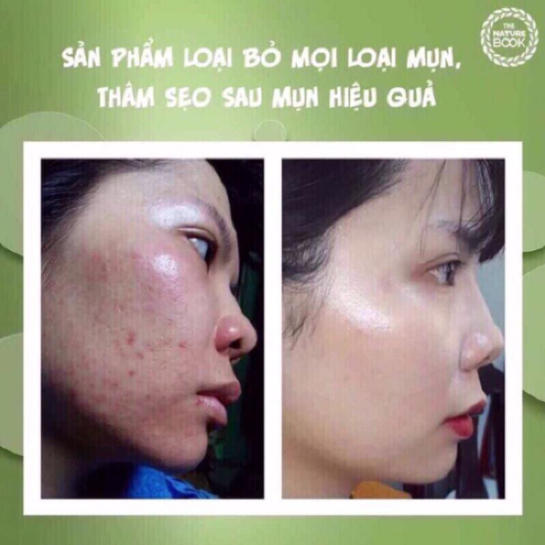 Kem Dưỡng Da Edally EX Sạch Mụn Hết Mụn Hết Thâm Dưỡng Da chống Lão Hoá The Nature Book 50g