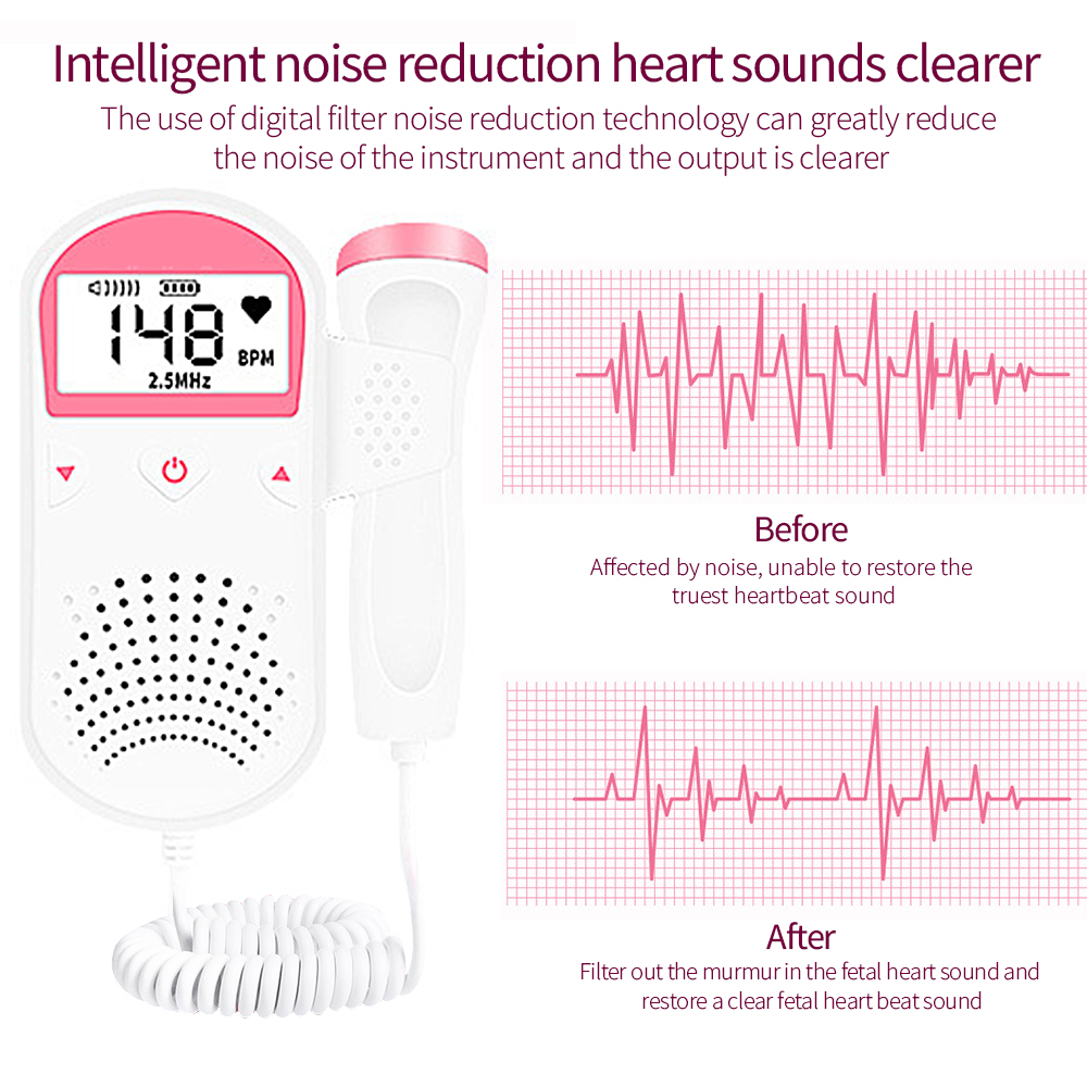LF Máy đo nhịp tim siêu âm Doppler thai nhi Máy đo nhịp tim 2,5MHz Máy theo dõi gia đình của thai nhi Không có bức xạ