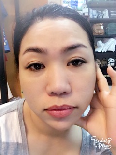 Thải độc da