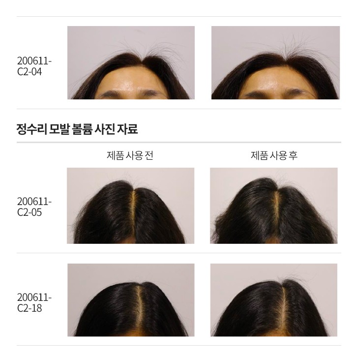 Dầu gội TS ngăn rụng tóc, kích thích mọc tóc chiết xuất vàng và thảo dược Hàn Quốc TS GOLD PLUS SHAMPOO 100ml/500ml
