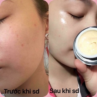 KEM NÁM NHẸ SWHITE