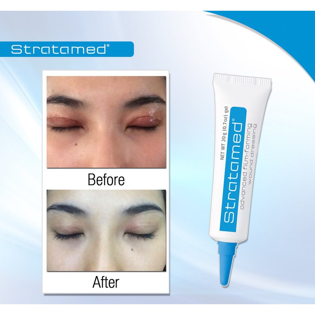 Gel Hỗ Trợ Làm Mờ Sẹo Và Vết Thương Hở Stratamed 20g - Thụy Sỹ