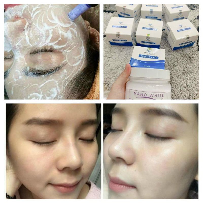 Cấy Trắng Serum Meso Matrigen