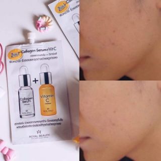 Serum 2 in 1 thái lan