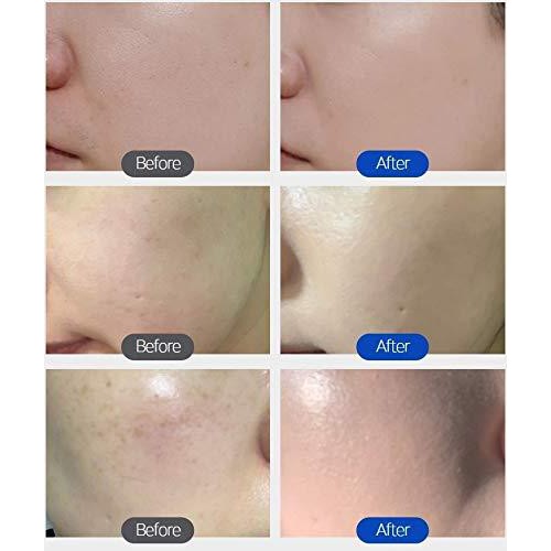 Kem nền dưỡng da Troiareuke BB  H+ cream | BigBuy360 - bigbuy360.vn