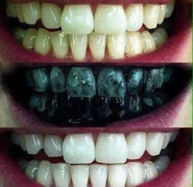 Bột trắng răng than tre hoạt tính zenpali