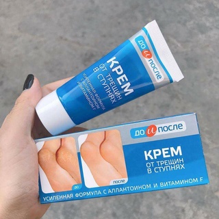 Kem  Nứt Gót Chân Kpem Apteka chính hãng Nga ( Date T8/2024)