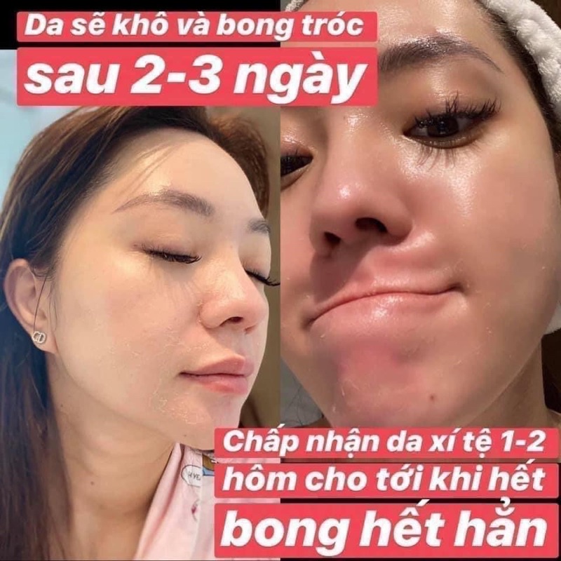 (hàng chính hãng)Tinh chất thay da sinh học NeoStrata ProSystem Retinol Peel