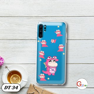 Ốp lưng dẻo cho Huawei P30 Pro