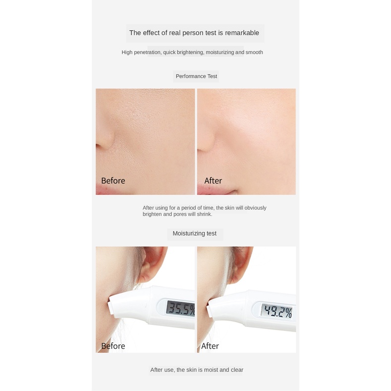 Serum Vitamin C Niacinamide Dưỡng Ẩm Tái Tạo Và Làm Trắng Da