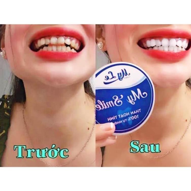 [SP CHÍNH HÃNG] Trắng răng than hoạt tính My Smile 70gr, bột đánh răng làm trắng răng từ than hoạt tính
