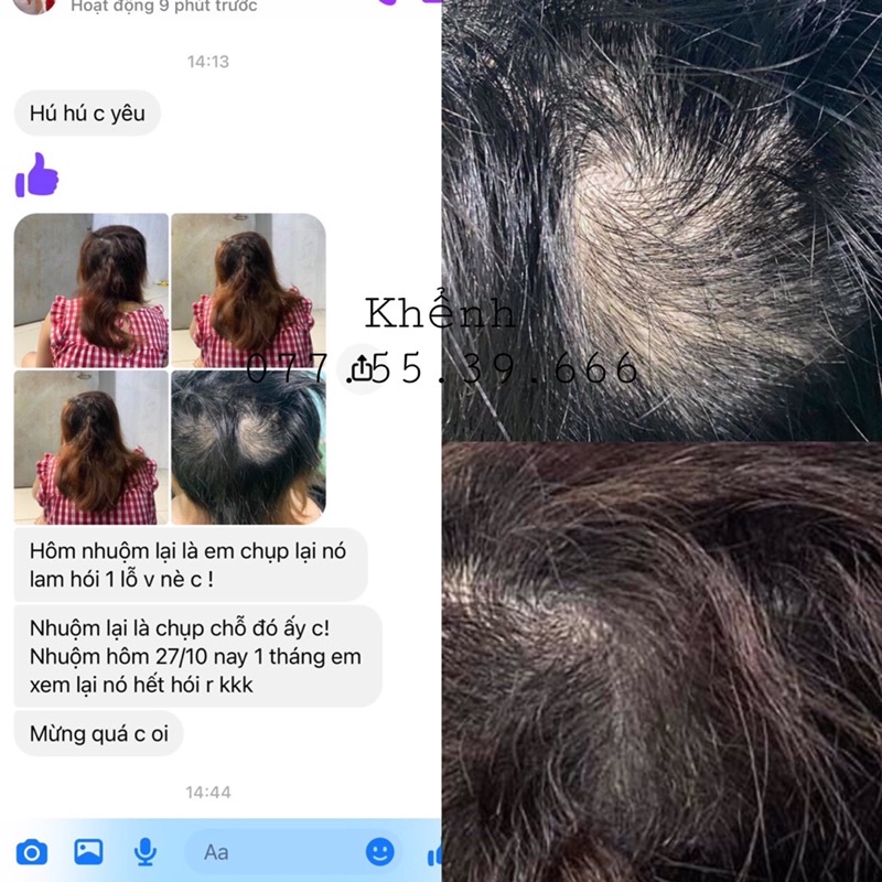 Dầu Ủ Oil Treatment Mọc Tóc Nhanh Dày Dài