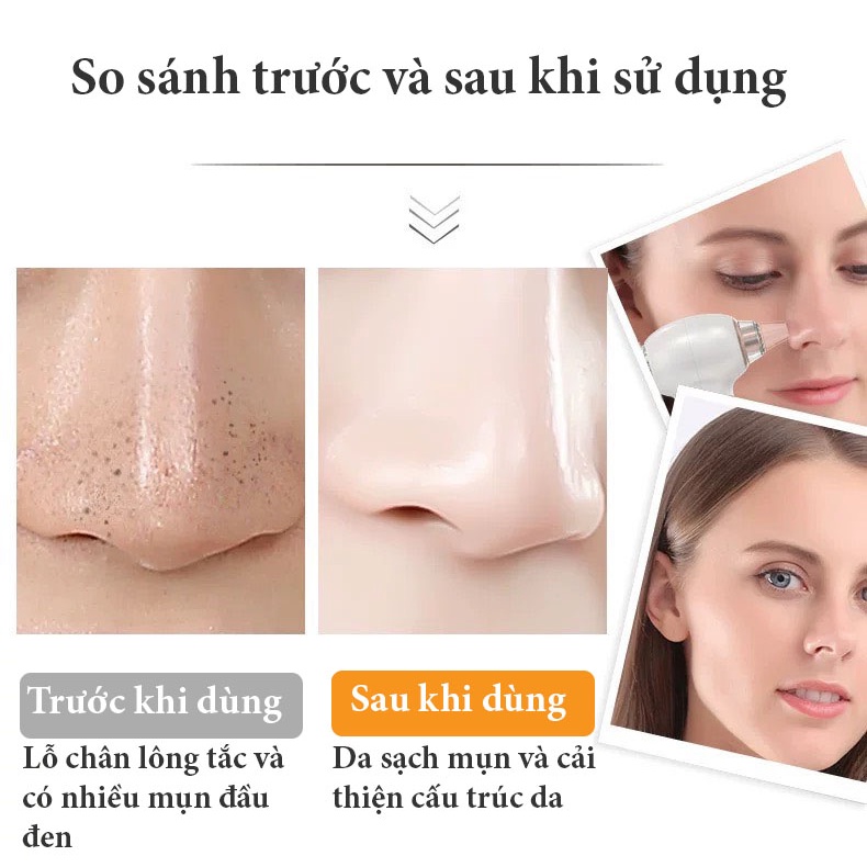 Máy hút mụn , máy hút mụn đầu đen, cám có đầu massage nhiệt tặng 5 đầu hút