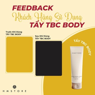 Tẩy TBC Body HM Store