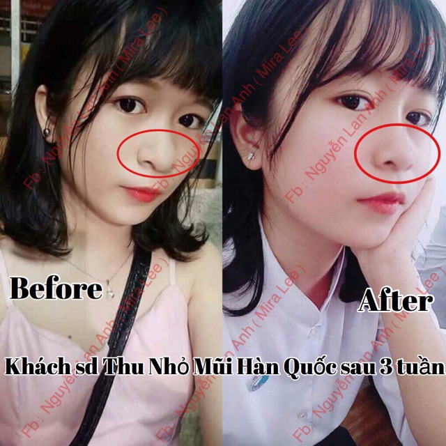 Tinh Chất Thu Nhỏ Mũi Hàn Quốc
