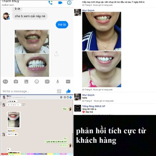 Bột Trắng Răng Smile Up Than Hoạt Tính
