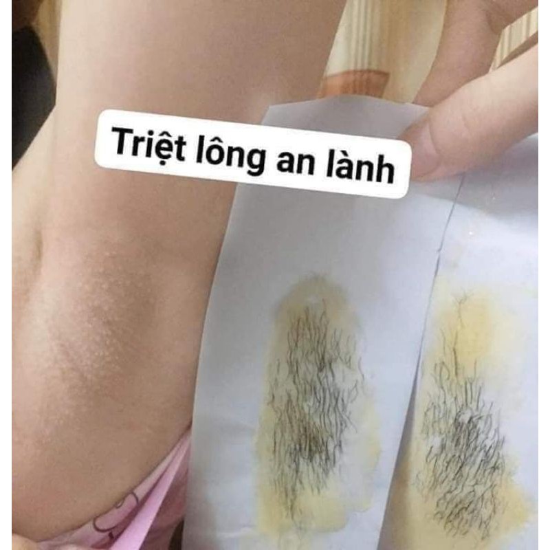 [CHÍNH HÃNG] Combo Wax lông An Lành và mỡ trăn (Tặng 50 tờ giấy và 2 que wax) | BigBuy360 - bigbuy360.vn