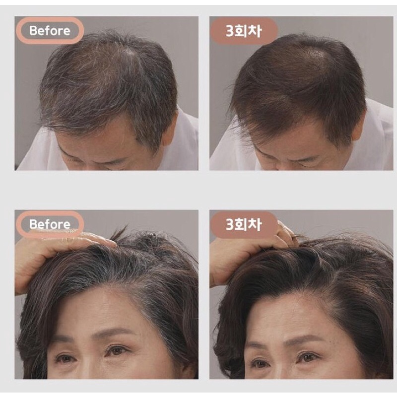 Dầu gội nano phủ bạc đạt Agefit co chứng nhận an toàn của Hàn Quốc