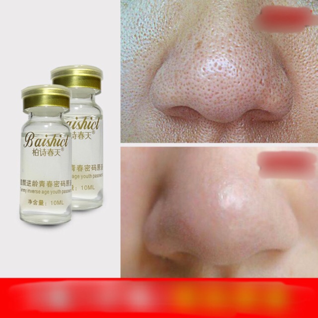 Hộp 5 Lọ tế bào gốc Baishict | BigBuy360 - bigbuy360.vn