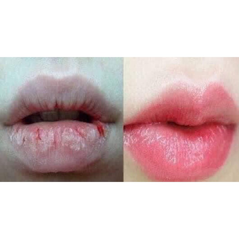 💋💋Son Dưỡng Giảm Thâm, Khô Môi Lips Care💋💋