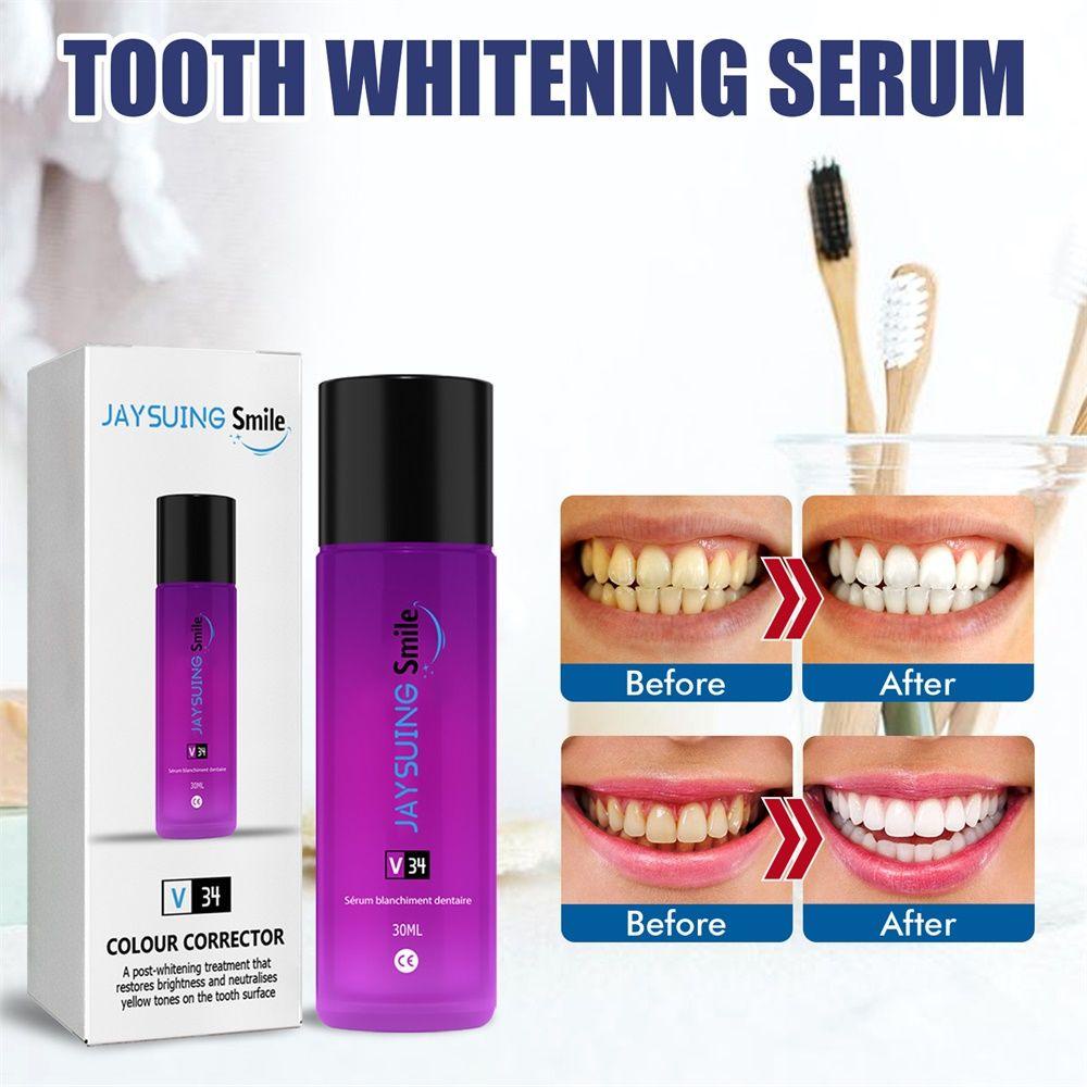 Serum Làm Trắng Răng Trị Vết Bẩn Và Vết Răng