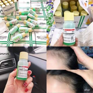 Thuốc bôi kích thích mọc tóc Sato