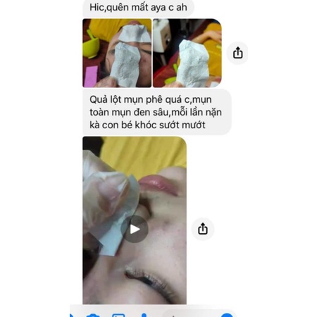 NƯỚC LỘT MỤN CÁM, MỤN ĐẦU ĐEN