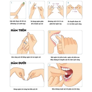 CHỉ NHA KHOA DENTANA