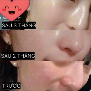 Sữa dưỡng ohui the first 140ml